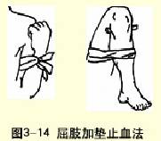  ��֫�ӵ�ֹѪ��