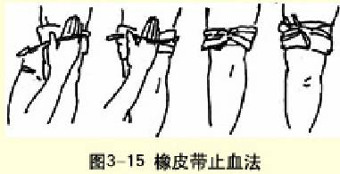  ��ƤֹѪ��ֹѪ��