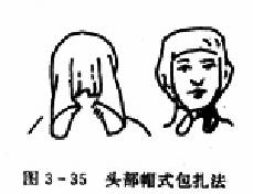  ͷ��ë��ñʽ����