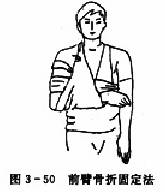  ǰ�۹��۹̶���