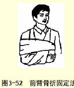  �޼а�ǰ��ǰ�۹��۹̶���