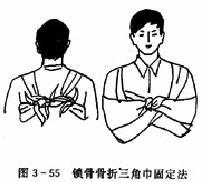  ���ǹ������ǽ��޼а�̶���