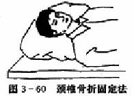  ��׵���۹̶���