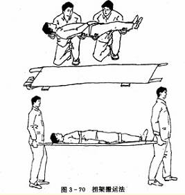  ̧���ܷ���