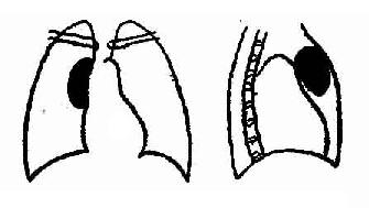 Ƥײλʾ<a href=