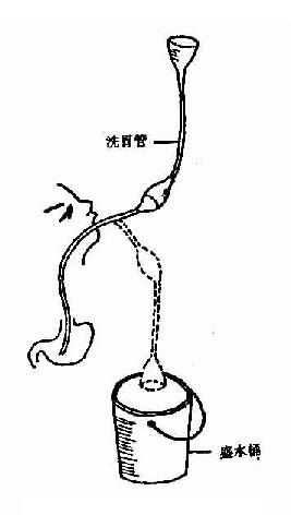 ©��θ��ϴθ��ʾ��ͼ