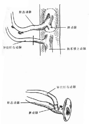 ζ-λҶƢǺ