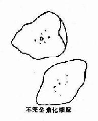 �����ƽ����״����Ƥ��������ϸ��ʾ��ͼ