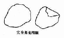 �����ƽ����״����Ƥ��������ϸ��ʾ��ͼ