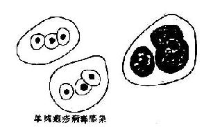 ������Ⱦʱ��̵ͿƬ�е�ϸ���ڰ�����