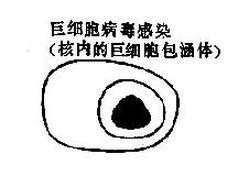 ������Ⱦʱ��̵ͿƬ�е�ϸ���ڰ�����