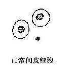 �������μ�Ƥϸ��