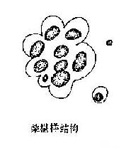 ��Ĥǻ��Һ�ڴ�ϸ������<a href=