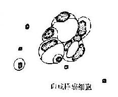 ��Ĥǻ��Һ�ڴ�ϸ������<a href=