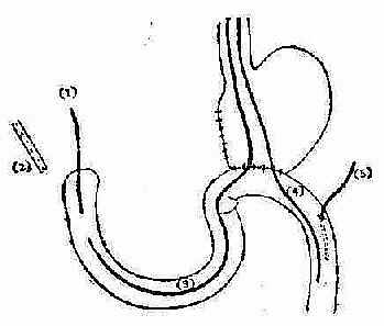 ʮ��ָ���ж����Ѵ���