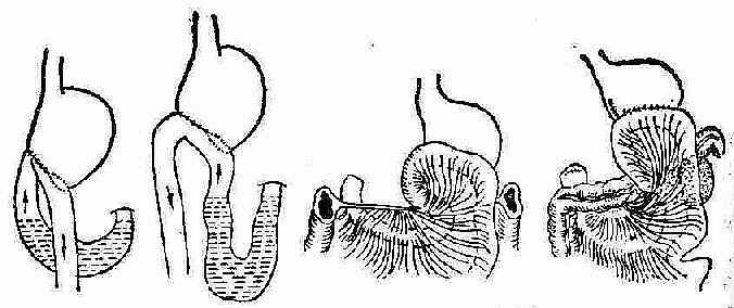 ����ճ��ᷢ������ļ���ԭ��