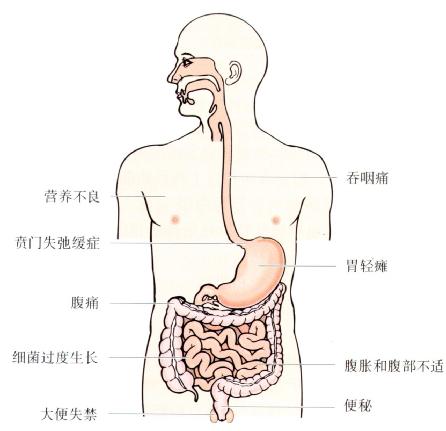 ԼԳ