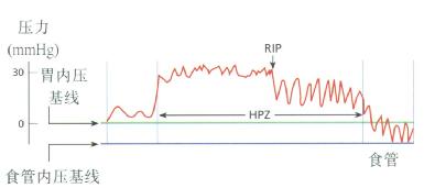 ѹܴθʳʱɼ⵽LESѹ