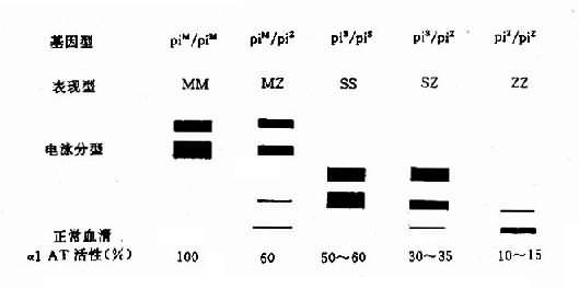 ������1AT�����͵�Ӿͼ�׼������