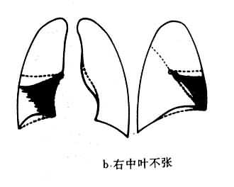 Ҷβ