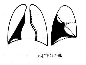 Ҷβ