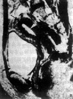 ŮԹMRI