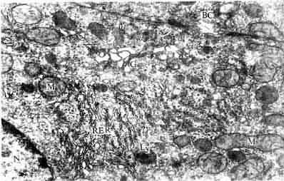 �����ϸ���羵�� 