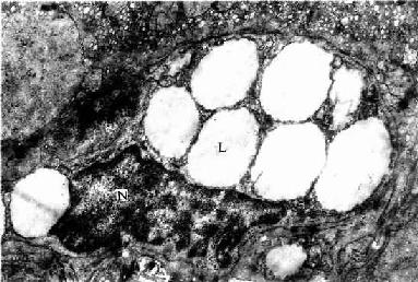 �˸���֬ϸ���羵�� 